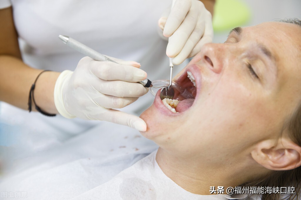 牙齿不整齐导致牙结石过多,牙结石导致牙齿松动洗牙后会好吗