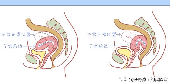 女生来大姨妈，为什么有的痛得要死，有的没啥感觉？