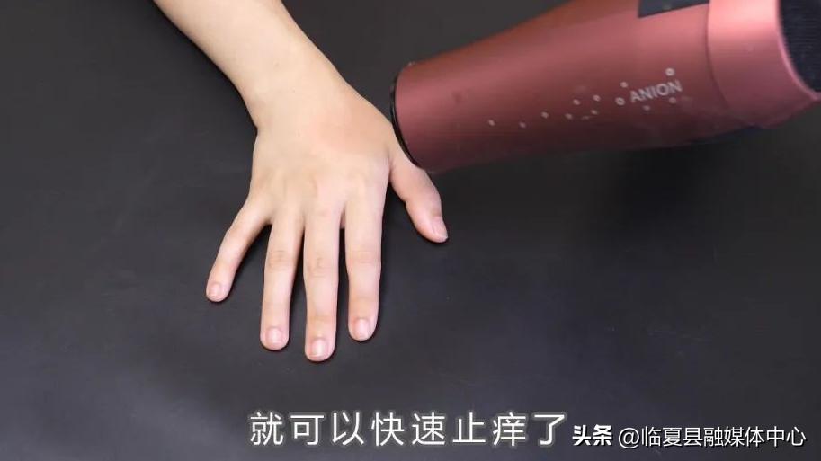 削山药后手很痒怎么快速止痒,手削了山药特别痒怎么办