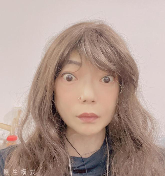 “最惨阔太”伍智恒：嫁豪门8年，换来牙齿全脱，体重仅剩44斤