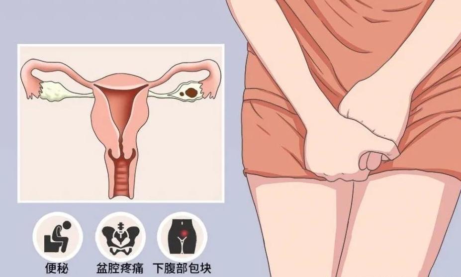 生娃子宫有什么变化,生过孩子女性有什么变化