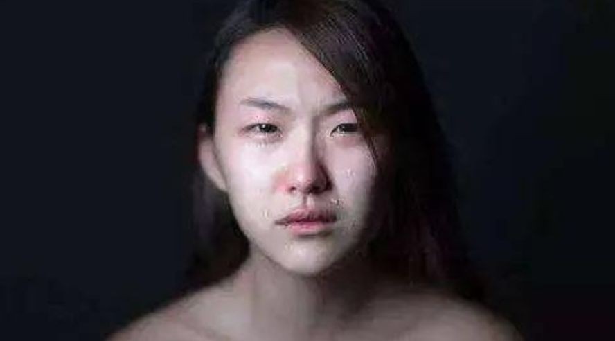 卖卵*市黑**盯准高颜值高学历女大学生，不麻醉，长针直接穿刺