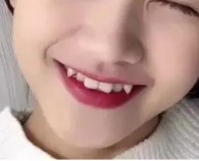 正畸医生为什么不建议植骨,正畸为什么医生不扶正智齿