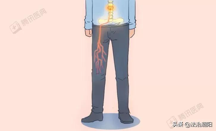 腰椎间盘突出睡硬板床更痛怎么办,睡软床得了腰椎间盘突出