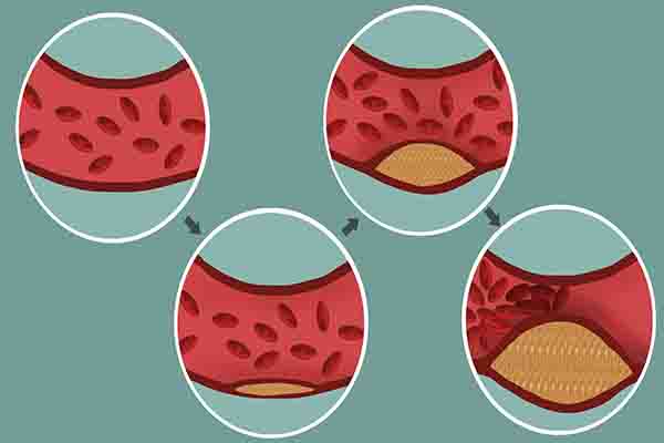 关于吃肉健康小知识,吃肉有讲究想要健康谨记这4点