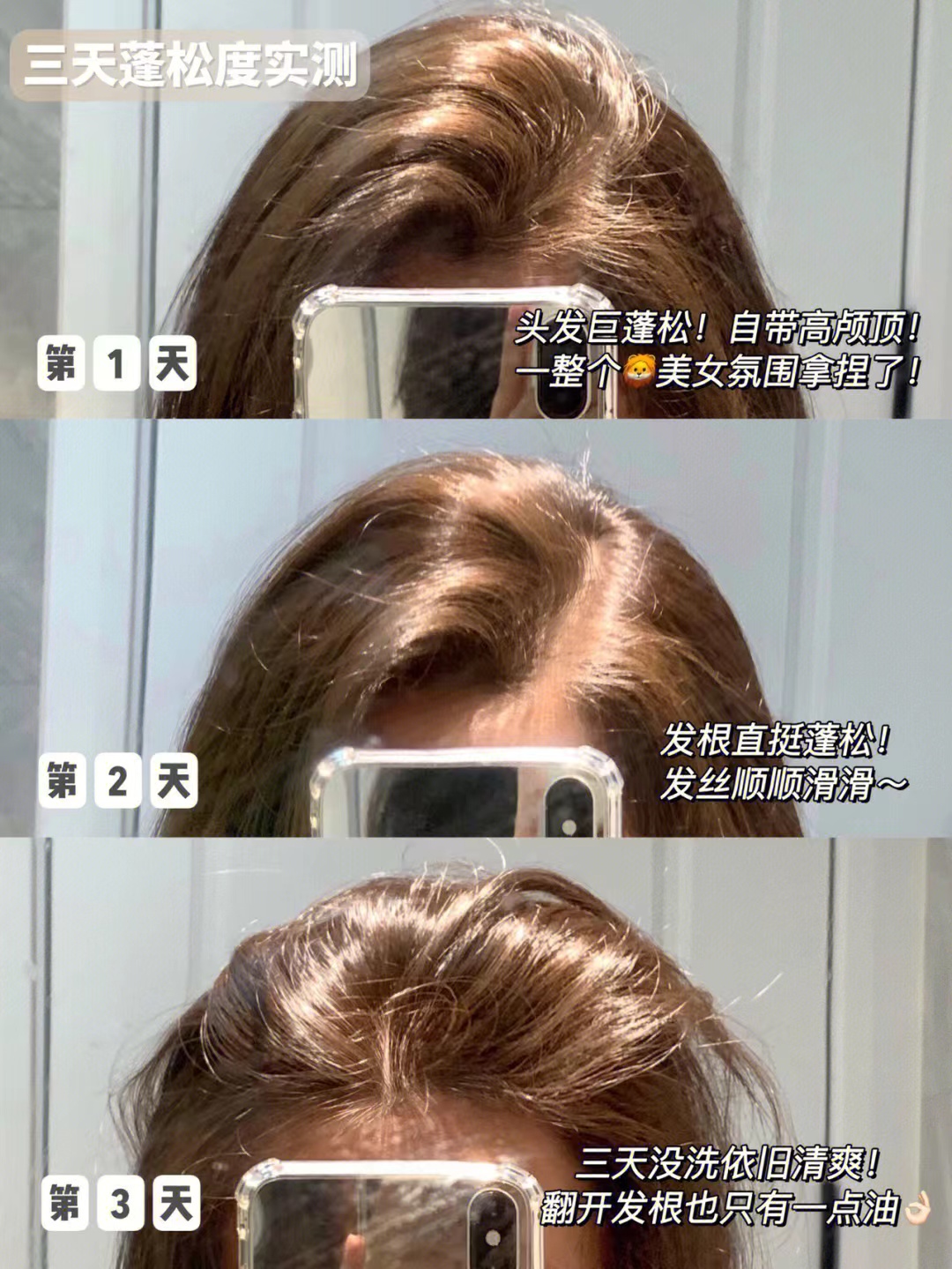 哪些因素会导致秃发,怎样可以停止斑秃继续掉发