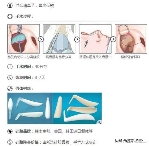 隆鼻最安全的是哪种隆鼻方法啊,先来了解一波隆鼻科普