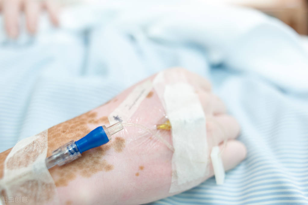 手部白癜风怎么治疗效果好,手部白癜风用什么药膏好得快