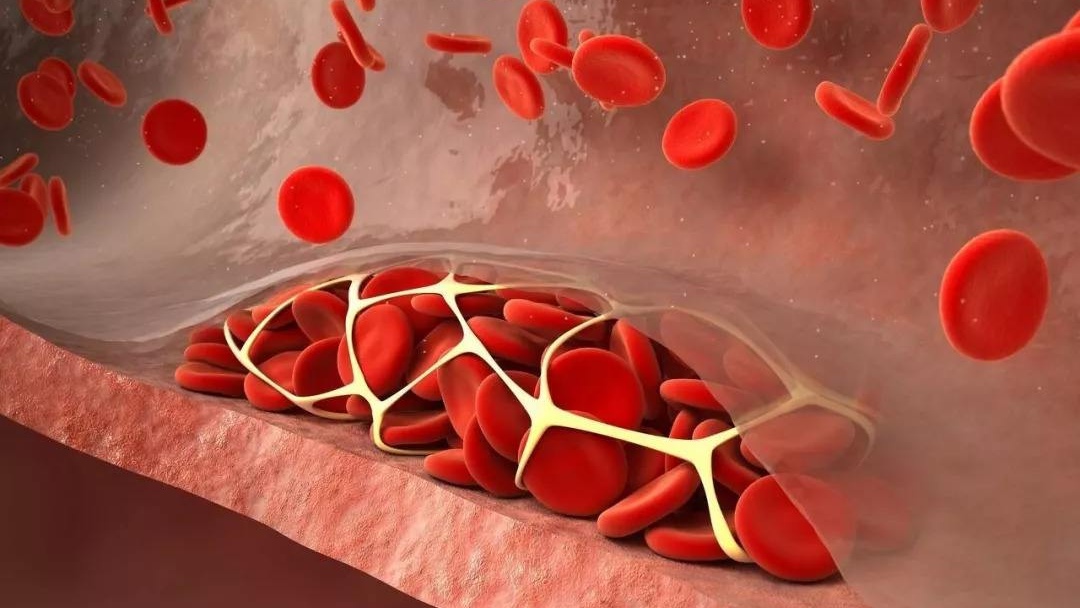 甲钴胺片治疗身体哪个地方的神经,甲钴胺治疗神经每天吃几片最好