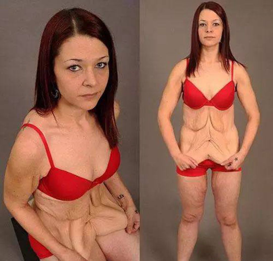 运动减肥后脸部皮肤松弛怎么办,减肥期间怎样能不让脸部皮肤松弛