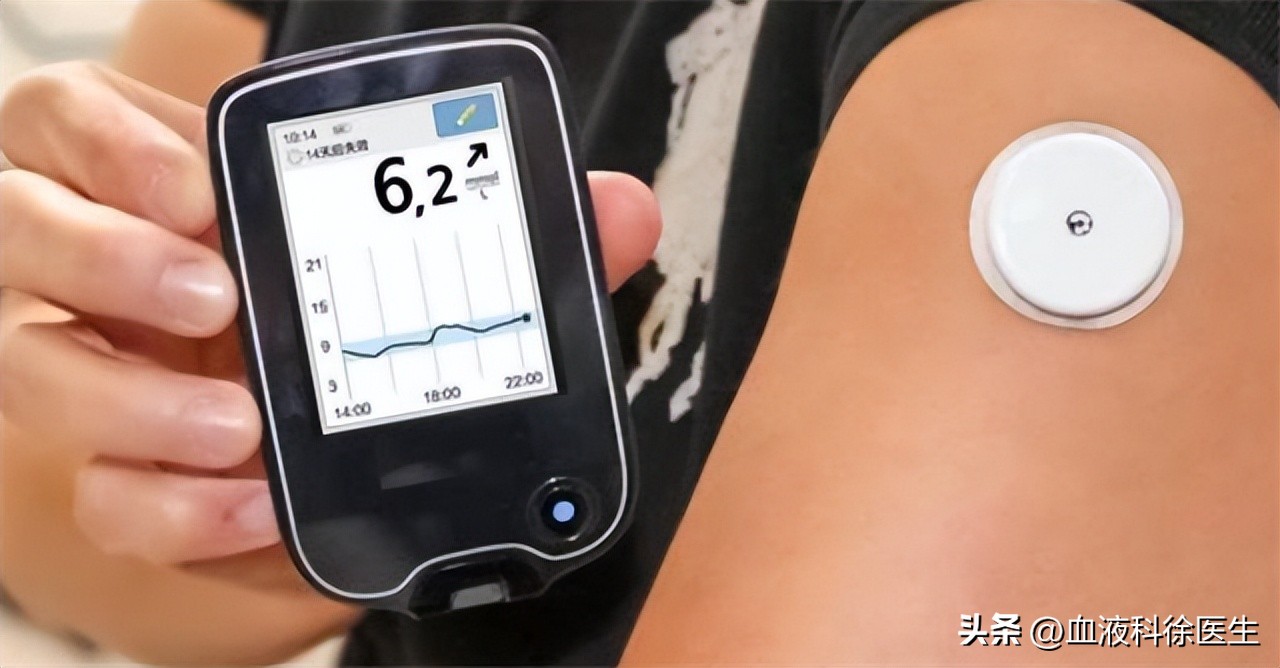 血糖高的人建议吃水果吗,血糖高的人吃水果注意什么