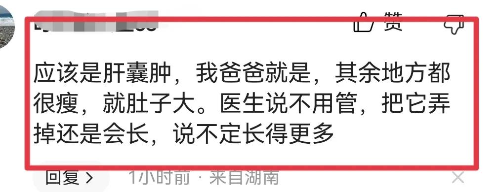 72岁谭咏麟自曝生病,谭咏麟回应大肚腩