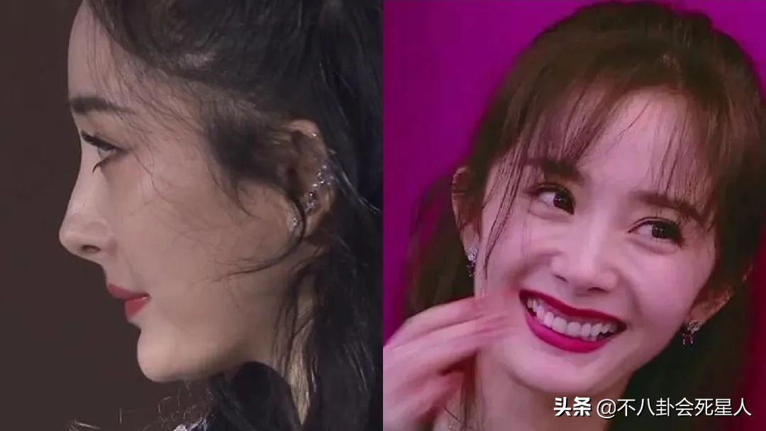 杨雪的脸怎么了,杨雪毁容了吗