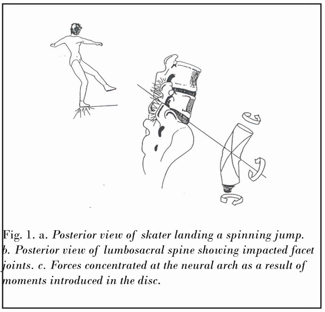 冰上芭蕾受伤,花样滑冰史上最严重的受伤