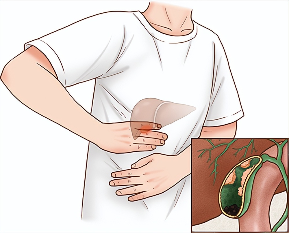 长息肉是癌症的前兆吗,体检查出有很小的息肉怎么办