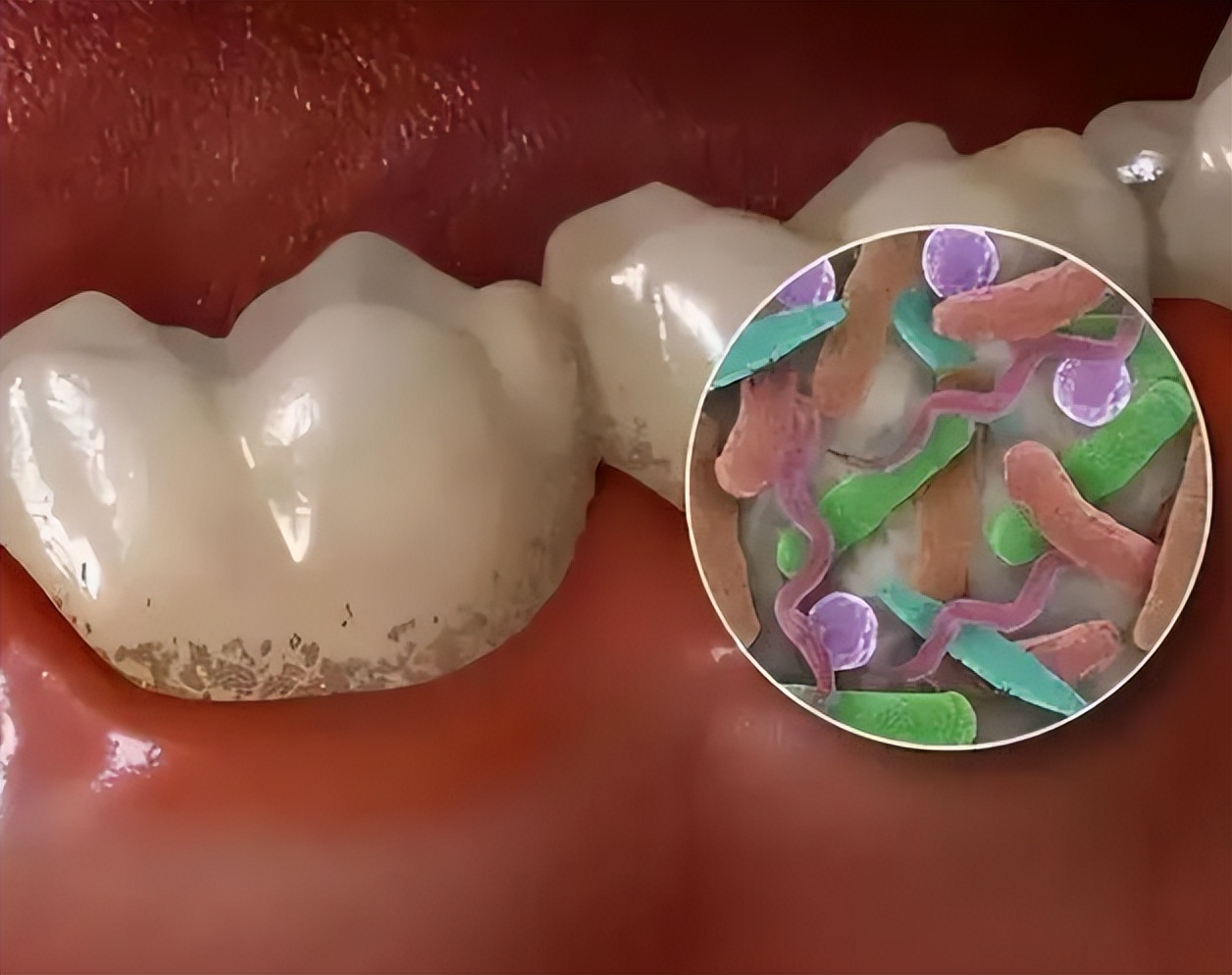 牙缝中抠出黄黄的东西,又软又臭,究竟是什么东西?看完长知识了