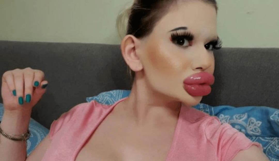 全网最厚嘴唇女网红,整容很多次网红厚嘴唇