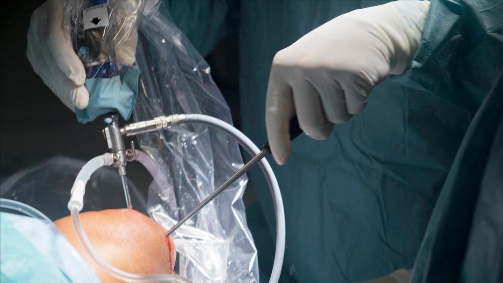 髌骨软化症走路腿发软没劲严重吗,上下楼梯膝盖疼屈膝疼怎么回事