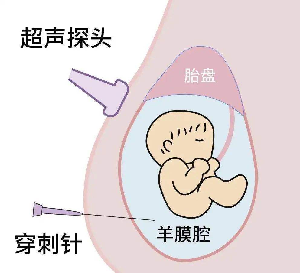 孕妇心率和孕吐有关系吗,孕吐严重生出的宝宝好带吗
