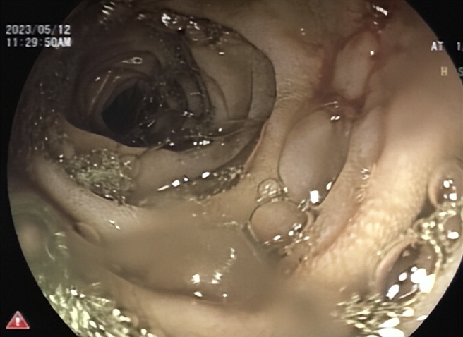 哈医大一院群力院区能体外碎石吗,哈医大一院激光科