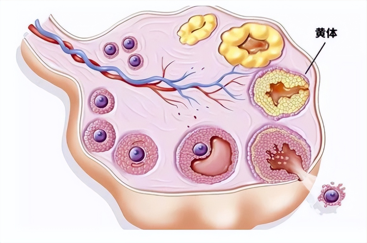 黄体二次破裂是什么原因,黄体二次破裂的可能性