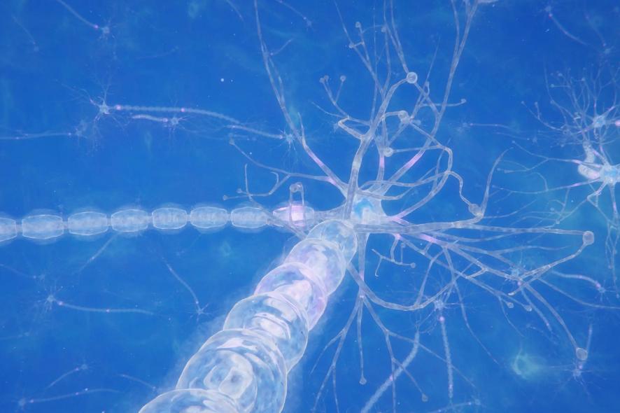 身体出现这8个症状，当心胰腺癌已找上门，及时发现趁早治疗