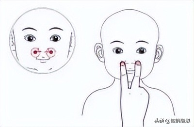 中医怎么治过敏性鼻炎流清涕不止,过敏性鼻炎眼睛痒的中医治疗方法