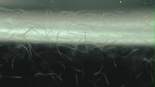 醋里面长出了一团肥肉,醋里长的肥肉