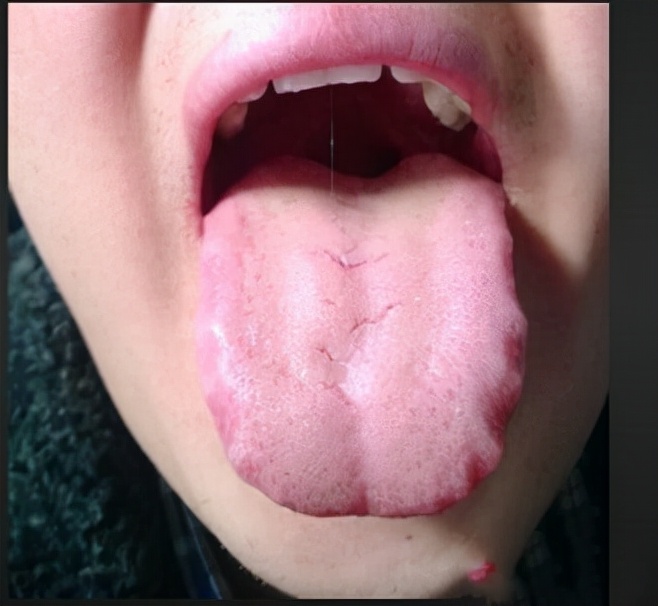 舌诊辨证和精准用药,中医诊病无需诊脉和观舌象靠谱不