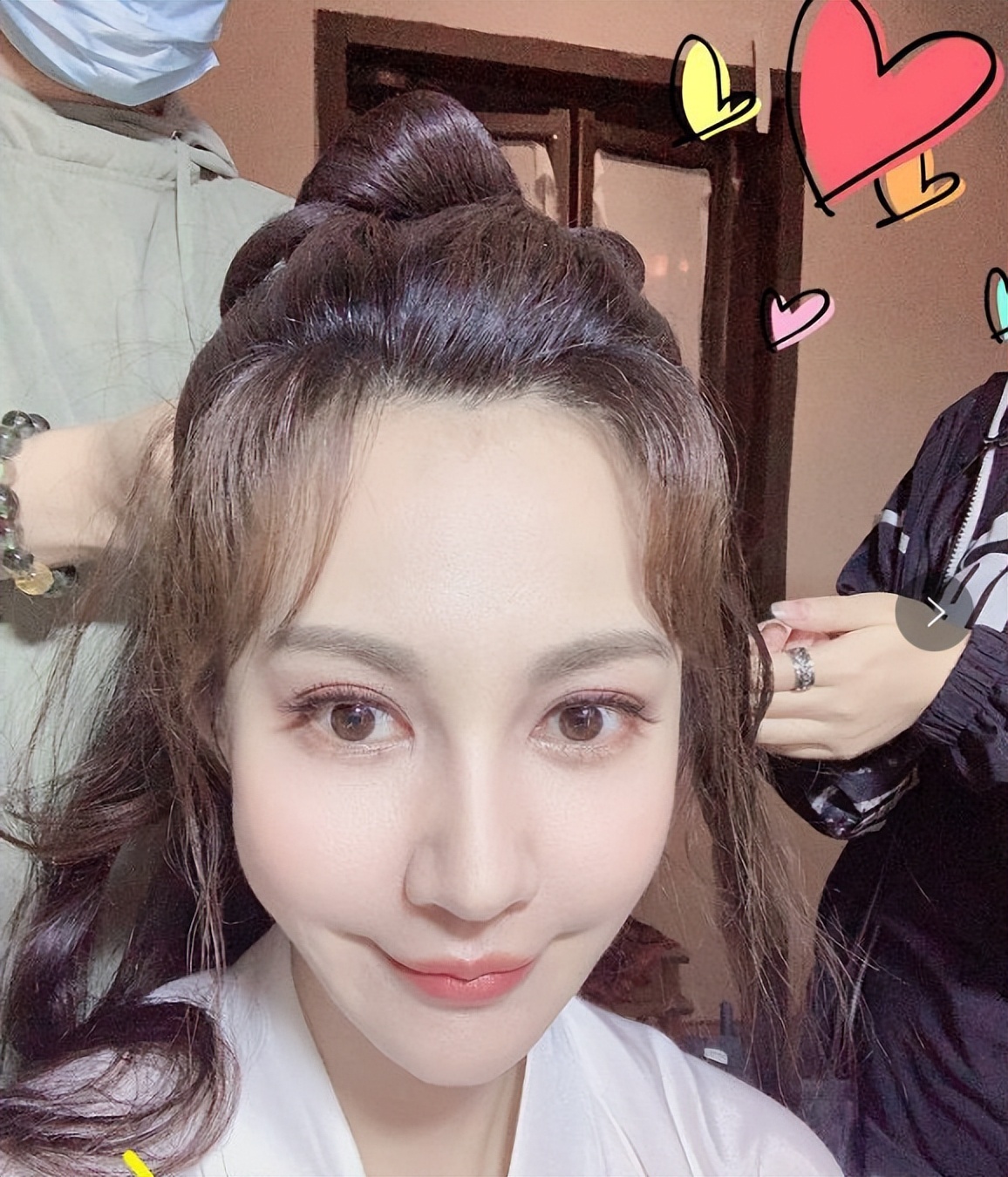 最近脸僵硬的女星,脸部变僵硬的女明星