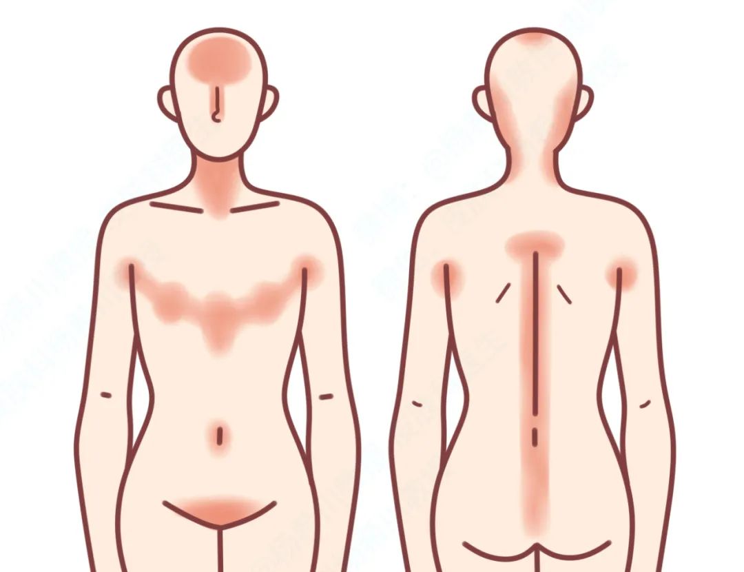 每到秋天，手和腿上就会出现各种干燥情况，还会脱皮，要怎么办？