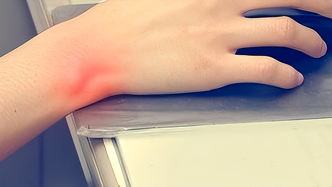 手指僵硬发胀怎么回事,手指僵硬预示哪些疾病