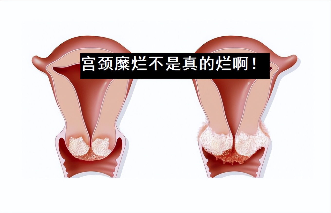 女子下身检查疼痛难忍,女性突然腹痛查出盆腔出血