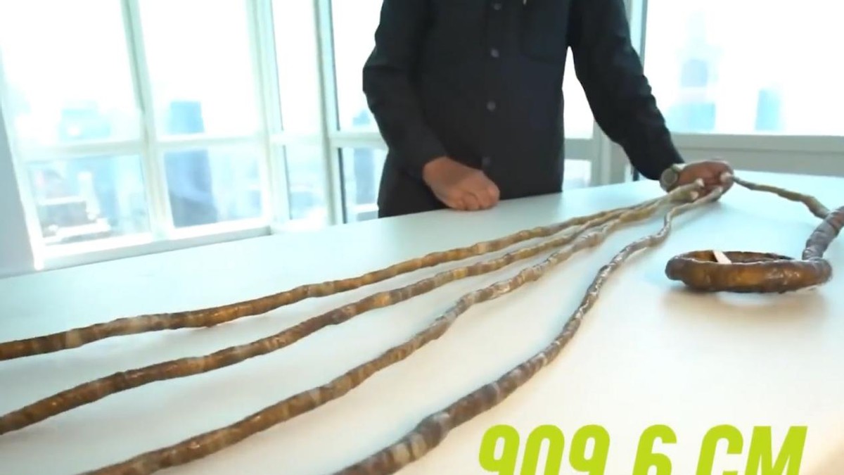 世界上身体部位最奇特的五个人,世界上身体最长的一个部位