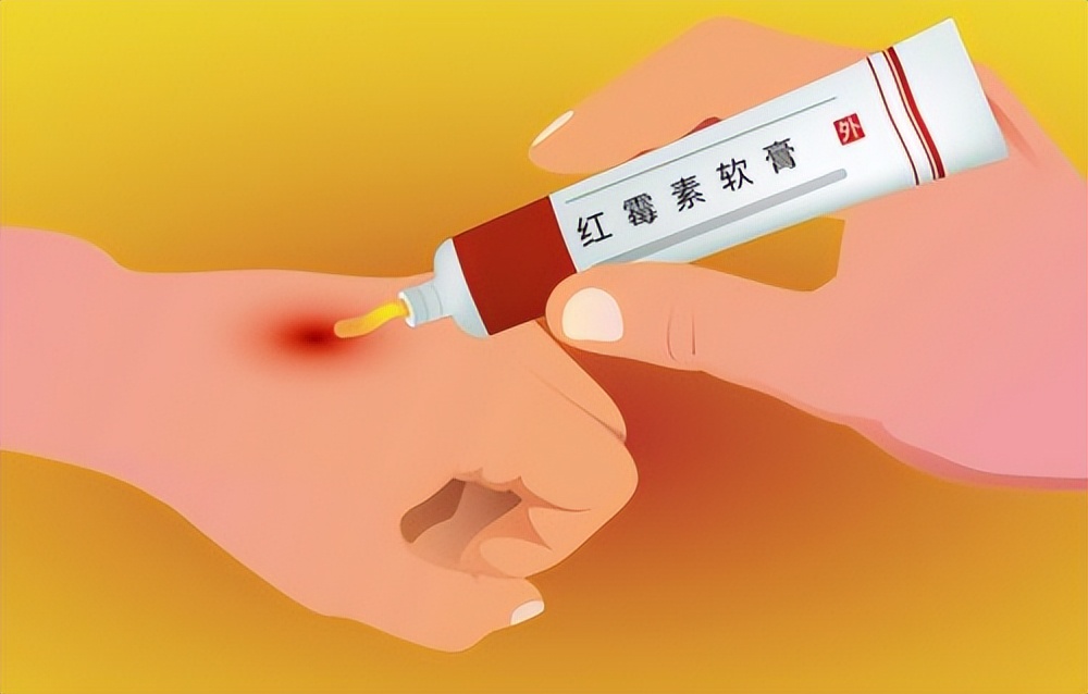 红霉素软膏可以去除老年斑吗,红霉素软膏怎么使用能祛老年斑