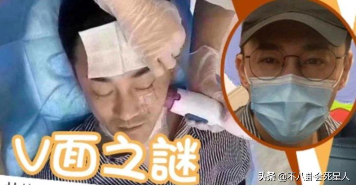 哪个女明星整容脸部变僵硬,整容脸vs自然脸的明星老去