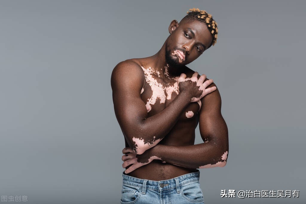 胸口上长白斑怎么办,白斑长在腋窝底下好治疗吗