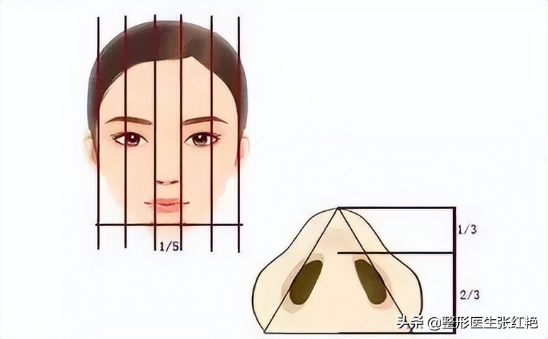 缩鼻翼怎么不留疤,缩鼻翼疤痕凸起