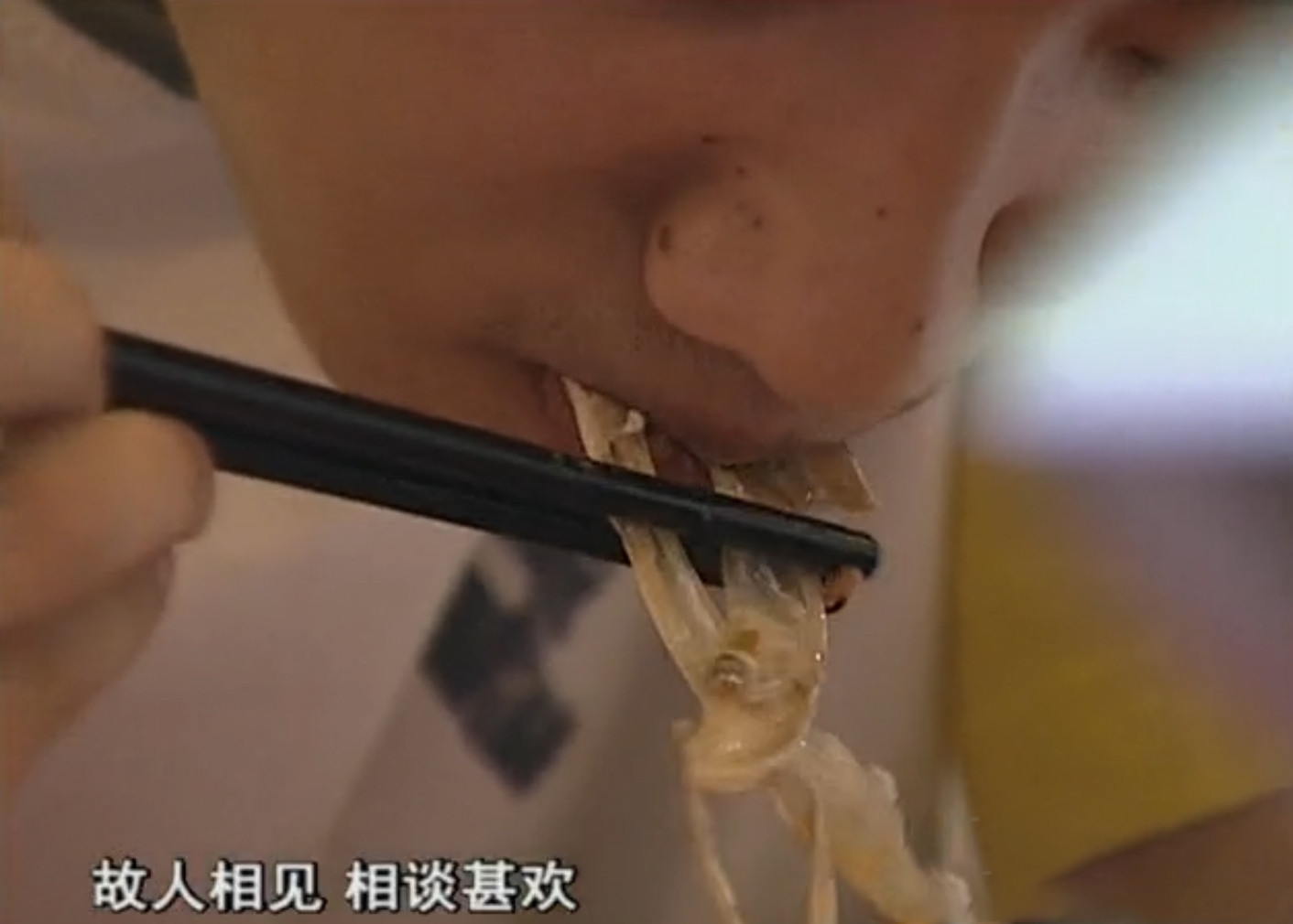 2010年,厦门小伙连续3月反复高烧,医生打开心脏夹出3厘米的鱼刺