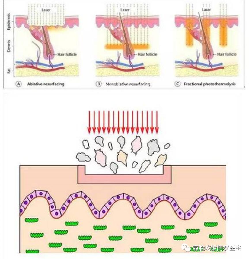 科普疤痕知多少,瘢痕科普视频