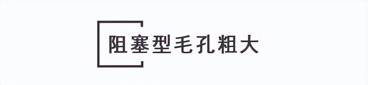 收缩毛孔粗大的方法,脸毛孔粗大的正确护肤方法