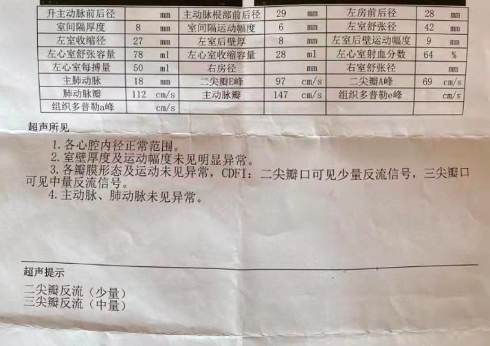 年轻女性心慌心律不齐什么原因,母亲心率慢如何治疗
