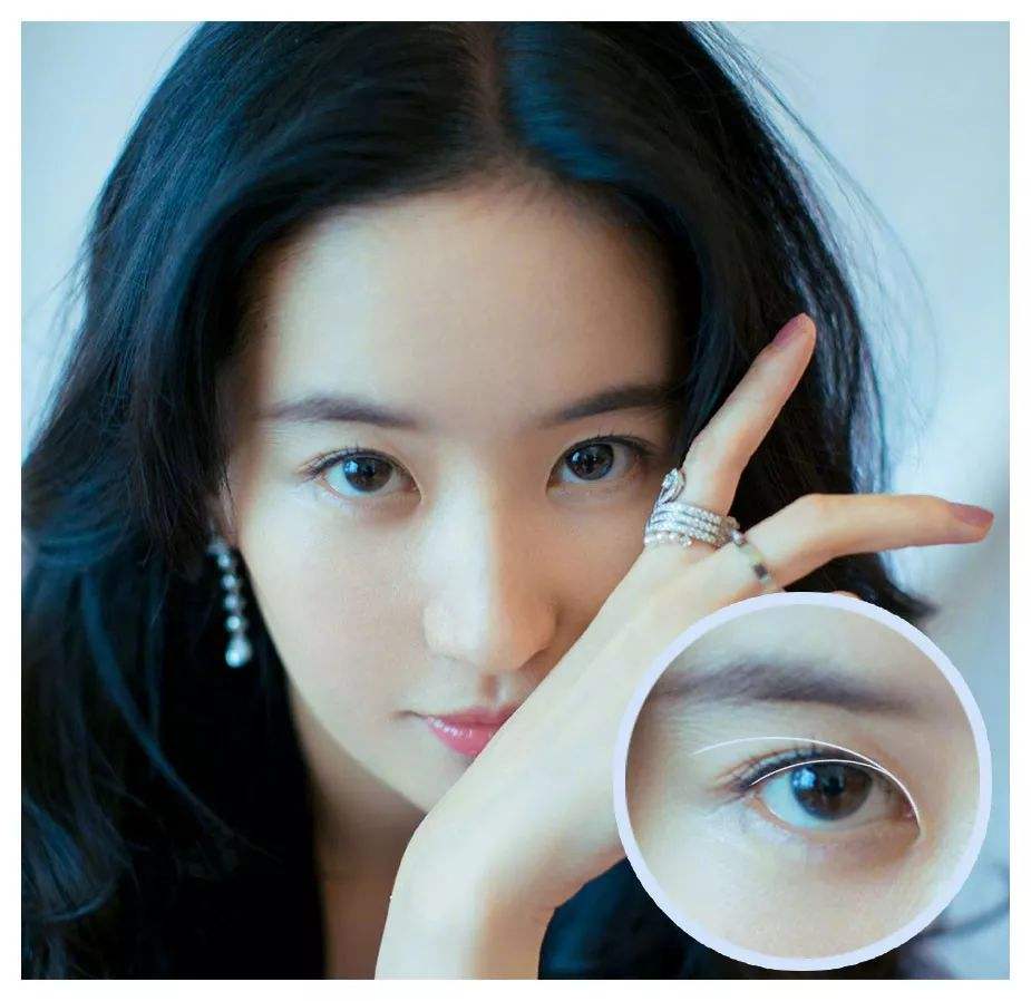 纠结要不要做飞秒,男士内双如何选择双眼皮手术