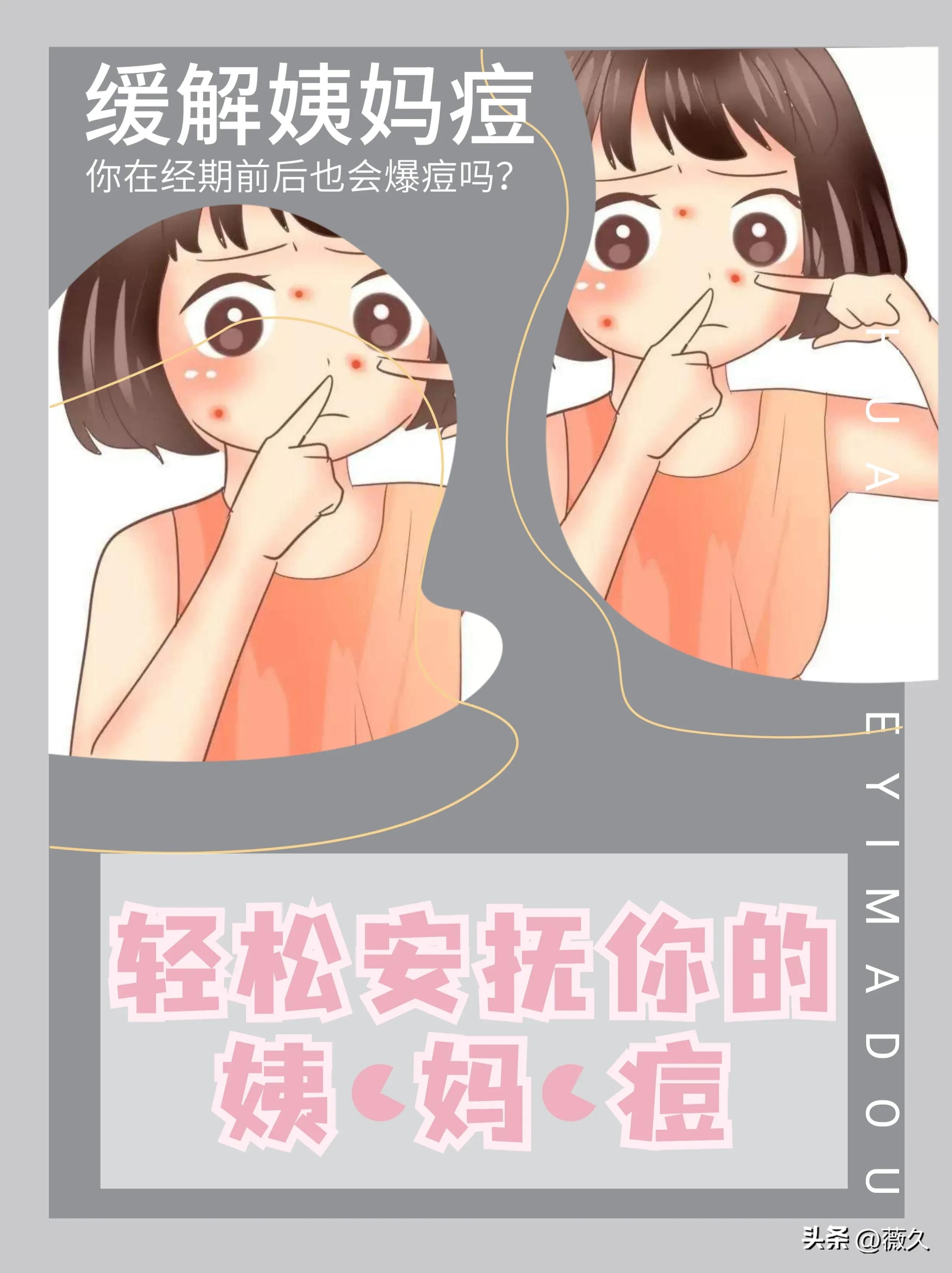 长姨妈痘怎么办,姨妈前长痘怎么调理