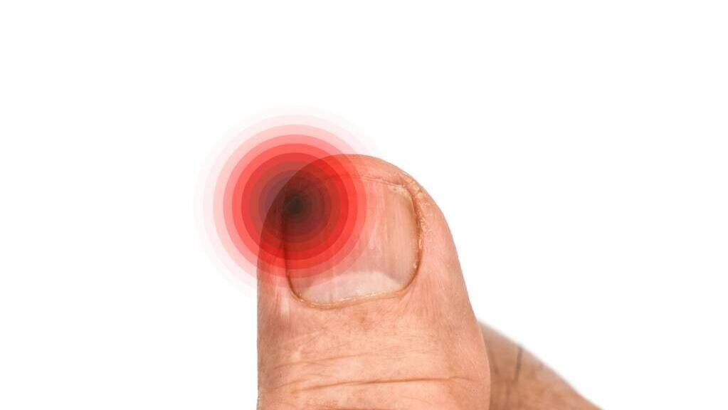 脚趾甲总往肉里钻,一碰就疼?医生教你3招,快速缓解