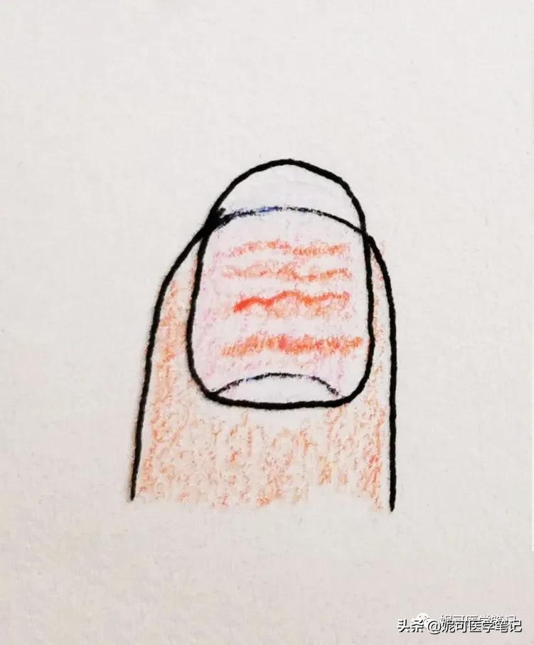 进行手部指甲养护的步骤,手部理疗和指甲护理