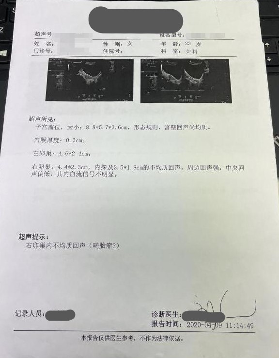 未婚姑娘查出卵巢癌,未婚女查出卵巢畸形瘤