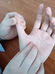 中风偏瘫手不能打开怎么办,中风偏瘫半边身体僵硬