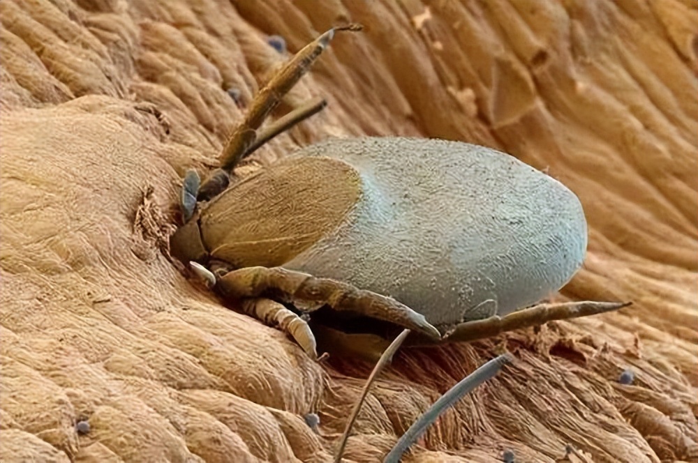 夺命蜱虫一般出现在哪里,致命蜱虫