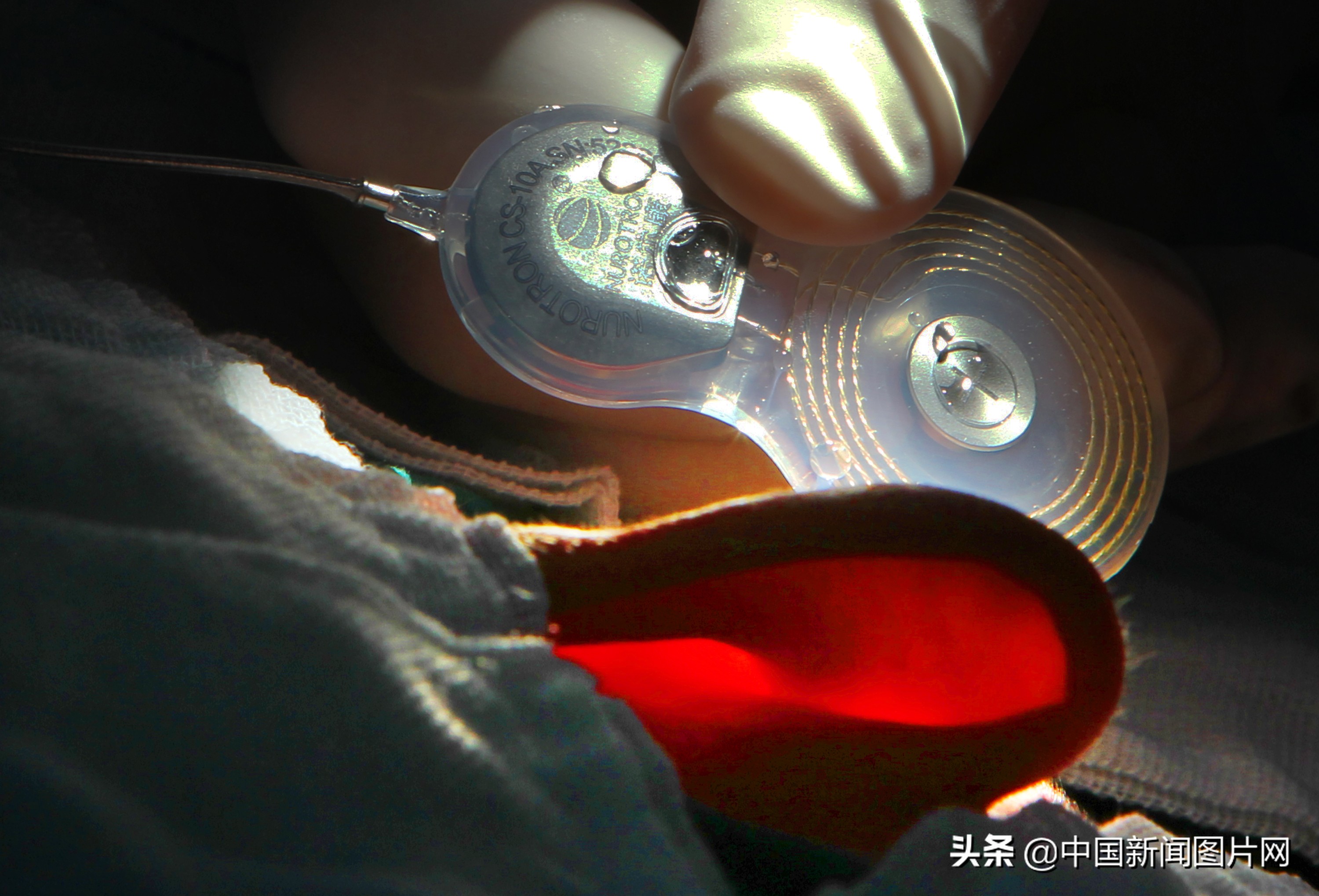 共建健康中国共享有声世界——惠州市第七届耳聪工程